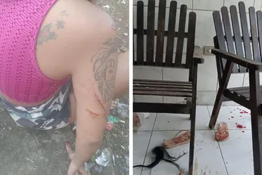 Imagem ilustrativa da imagem Filha e amiga simulam sequestro e se automutilam para extorquir R$ 50 mil da mãe