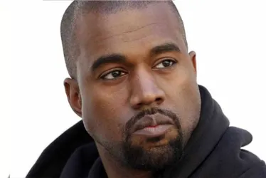 Imagem ilustrativa da imagem Kanye West coloca prótese de titânio de R$ 4 milhões nos dentes