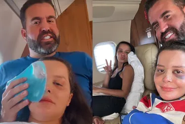 Imagem ilustrativa da imagem Maraisa mostra hematomas no rosto após acidente em piscina de resort