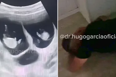 Imagem ilustrativa da imagem Pai desmaia ao descobrir que esposa está grávida de trigêmeos