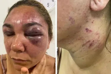 Imagem ilustrativa da imagem Vítima de violência doméstica no ES escreve carta aberta: "Não estamos sozinhas"