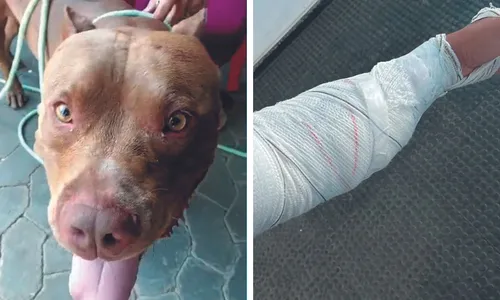 
          Imagem ilustrativa da imagem Ataques de cães assustam moradores nos bairros
          