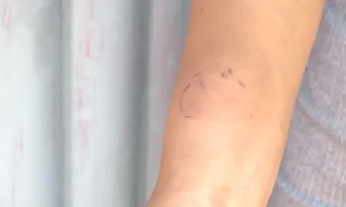 
          Imagem ilustrativa da imagem Balconista é agredida pelo marido por causa de presente de natal na Serra
          