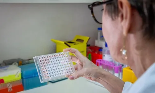 
          Imagem ilustrativa da imagem Butantan desenvolve teste capaz de detectar a leptospirose em estágio inicial
          