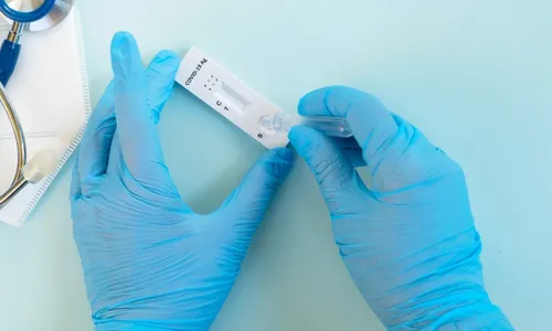 
          Imagem ilustrativa da imagem Cloroquina matou 17 mil pessoas na primeira onda de covid
          