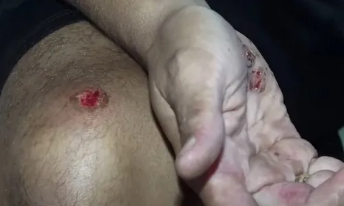 
          Imagem ilustrativa da imagem Entregador de pizza é assaltado após sofrer acidente
          