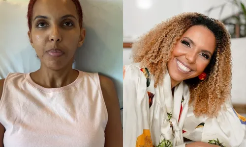 
          Imagem ilustrativa da imagem Ex-jornalista da Globo baleada no Carnaval recebe alta
          