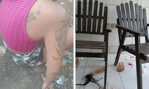 
          Imagem ilustrativa da imagem Filha e amiga simulam sequestro e se automutilam para extorquir R$ 50 mil da mãe
          