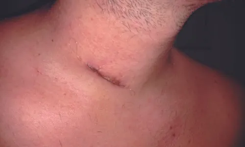 
          Imagem ilustrativa da imagem "Fui flagrado duas vezes e perdi a carteira", diz empresário
          