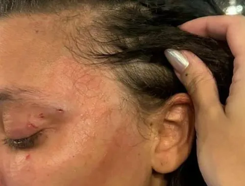 
          Imagem ilustrativa da imagem Homem que agrediu mulher em restaurante se pronuncia através de advogados
          