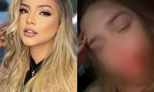 
          Imagem ilustrativa da imagem Modelo sofre corte no rosto e denuncia síndico de prédio por agressão
          