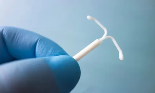 
          Imagem ilustrativa da imagem Mulher acusa médico do SUS por inserção errada de DIU em São Paulo
          