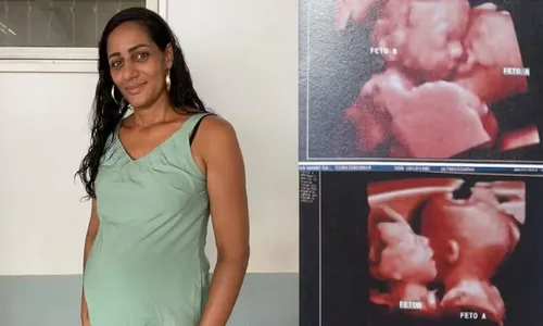 
          Imagem ilustrativa da imagem Mulher descobre gravidez de gêmeas que dividem um só coração
          