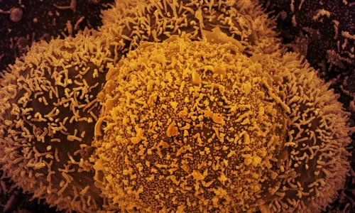 
          Imagem ilustrativa da imagem Mulher morre após ser diagnosticada com nova subvariante da Covid-19
          