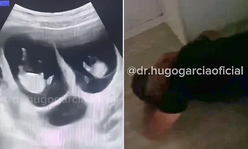 
          Imagem ilustrativa da imagem Pai desmaia ao descobrir que esposa está grávida de trigêmeos
          