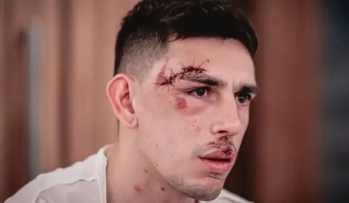 
          Imagem ilustrativa da imagem Polícia diz já ter identificado suspeitos envolvidos no atentado contra o Fortaleza
          