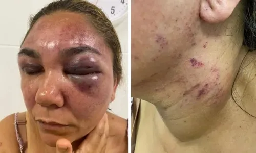 
          Imagem ilustrativa da imagem Vítima de violência doméstica no ES escreve carta aberta: "Não estamos sozinhas"
          