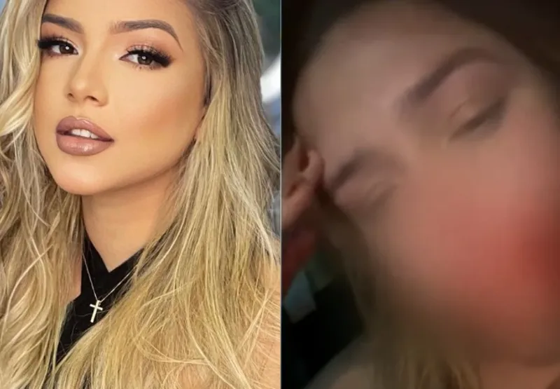 Modelo Mariana Lopes de Meneses compartilhou vídeo com face ensanguentada após agressão