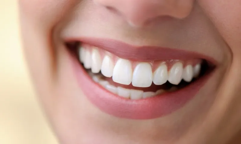 Imagem ilustrativa da imagem Alimentação e sorriso, existe relação?