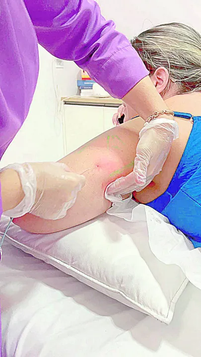 Imagem ilustrativa da imagem Recuperação mais rápida e sem bisturi