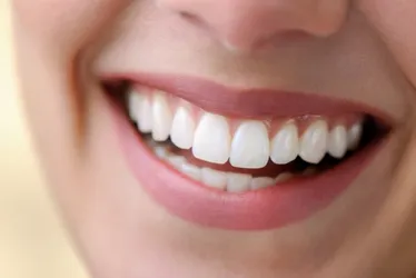 Imagem ilustrativa da imagem Alimentação e sorriso, existe relação?