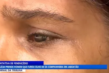 Imagem ilustrativa da imagem Mulher com olho perfurado por ex-namorado ajuda a prendê-lo se passando por outra
