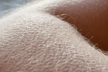 Imagem ilustrativa da imagem Nossa envolvente pele