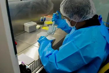 Imagem ilustrativa da imagem Novo teste de HPV no SUS pode antecipar diagnóstico em até 10 anos