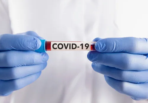 
          Imagem ilustrativa da imagem Governo ignora covid, que matou 283 em 1 semana
          