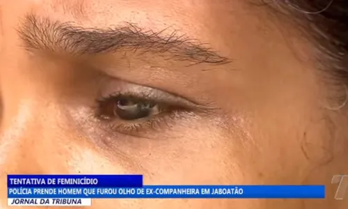 
          Imagem ilustrativa da imagem Mulher com olho perfurado por ex-namorado ajuda a prendê-lo se passando por outra
          