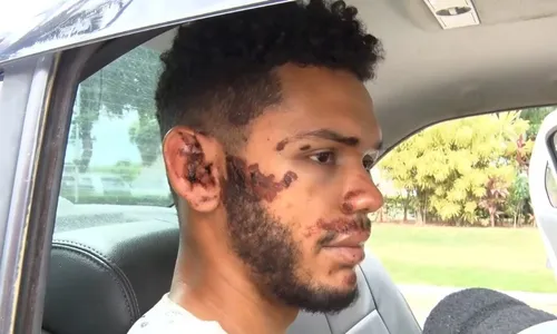 
          Imagem ilustrativa da imagem Sobrevivente de acidente na Serra: “Eu pedi para dirigir mas ele não deu atenção”
          