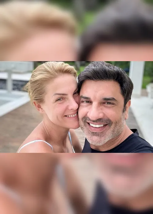 Imagem ilustrativa da imagem Ana Hickmann "testou" Edu Guedes em começo de namoro