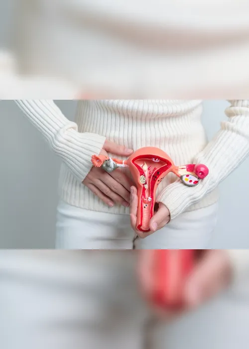 
          Imagem ilustrativa da imagem Endometriose
          