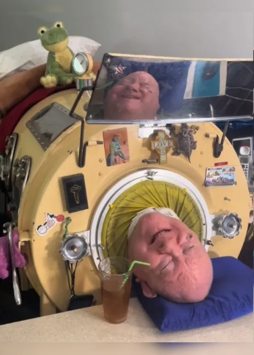 Imagem ilustrativa da imagem Homem que viveu com pulmão de ferro por 70 anos morre de covid