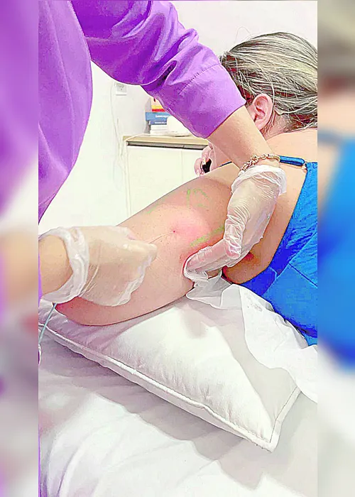 Imagem ilustrativa da imagem Recuperação mais rápida e sem bisturi