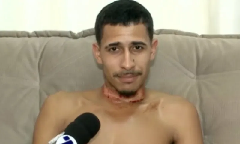 Imagem ilustrativa da imagem Motoboy sofre queimaduras no pescoço após ser atingido por fios em Cariacica