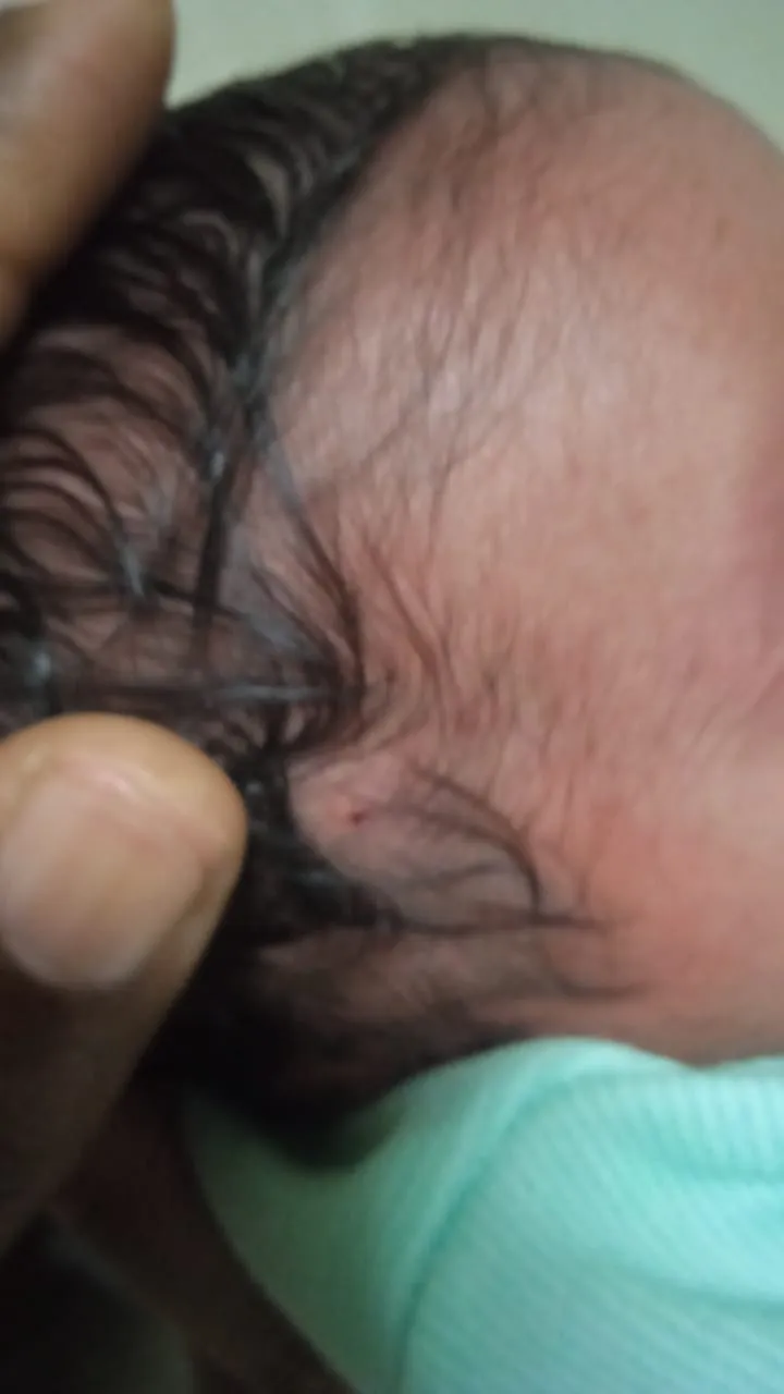 Imagem ilustrativa da imagem Recém-nascida é atingida por bala perdida no hospital, horas depois de nascer