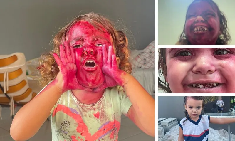 Imagem ilustrativa da imagem Situação inusitada: Criança viraliza na internet após pintar rosto com batom no ES