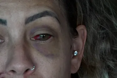 Imagem ilustrativa da imagem "Chama a polícia!": dona de hostel apelou por socorro durante agressão