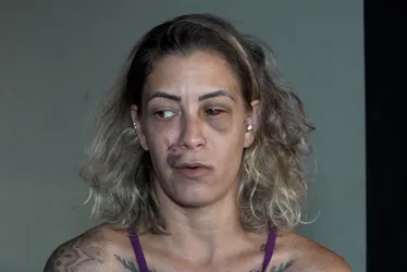 Imagem ilustrativa da imagem "Chama a polícia!": dona de hostel apelou por socorro durante agressão
