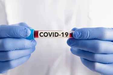 Imagem ilustrativa da imagem Gripe e covid-19 provocam aumento de casos de síndrome respiratória em São Paulo