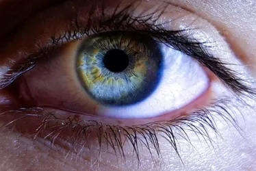 Imagem ilustrativa da imagem Glaucoma ameaça a visão de quase 100 milhões até 2030