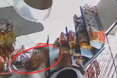 Imagem ilustrativa da imagem Menino de 7 anos tem orelha mutilada após ser atacado por cão no ES