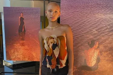 Imagem ilustrativa da imagem Modelo que nasceu careca desmistifica a alopecia
