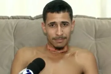Imagem ilustrativa da imagem Motoboy sofre queimaduras no pescoço após ser atingido por fios em Cariacica