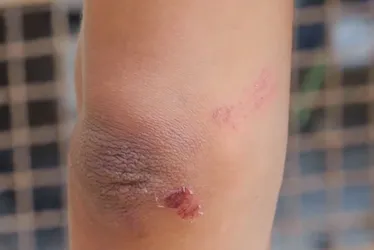 Imagem ilustrativa da imagem Mulher é agredida e tem nariz quebrado ao sair de festa em Vitória
