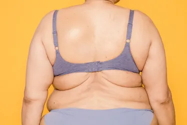 
          Imagem ilustrativa da imagem Obesidade: tratamento requer envolvimento do poder público
          