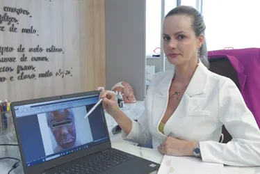 Imagem ilustrativa da imagem Peeling de fenol: tratamento de beleza pode afetar coração e rins