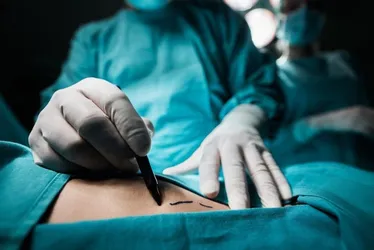 Imagem ilustrativa da imagem “Sonho da cirurgia estética virou pesadelo”, diz cabeleireira