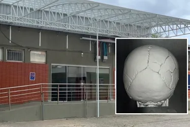 Imagem ilustrativa da imagem Bebê de um ano espancada pelo padrasto na Serra recebe alta